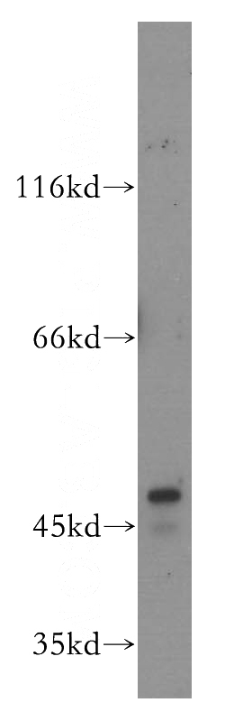 mouse liver tissue were subjected to SDS PAGE followed by western blot with Catalog No:113624(PDK1 antibody) at dilution of 1:500