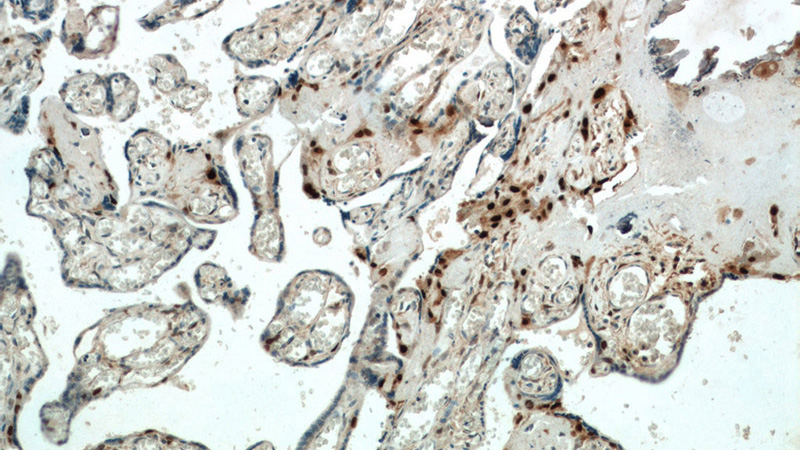 Immunohistochemistry of paraffin-embedded human placenta tissue slide using Catalog No:113554(CDKN1C Antibody) at dilution of 1:200 (under 10x lens)