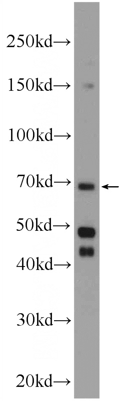 HeLa cells were subjected to SDS PAGE followed by western blot with Catalog No:110335(ENTPD7 Antibody) at dilution of 1:300