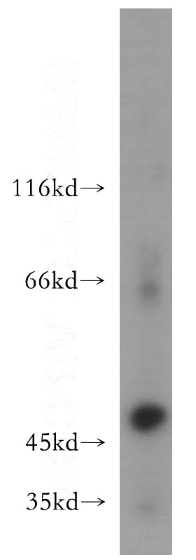 A549 cells were subjected to SDS PAGE followed by western blot with Catalog No:112706(MMP3 antibody) at dilution of 1:500