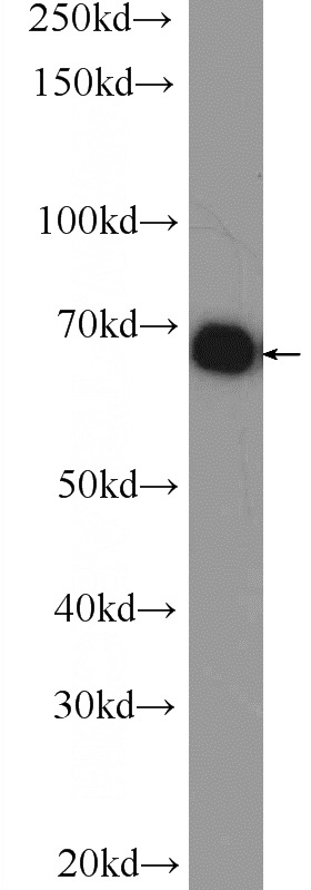 Jurkat cells were subjected to SDS PAGE followed by western blot with Catalog No:115981(TAF15 Antibody) at dilution of 1:600