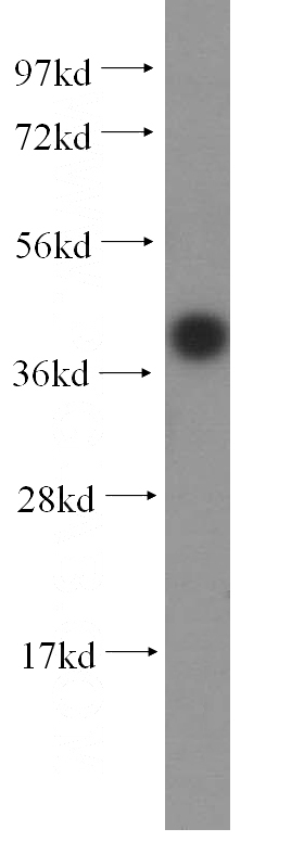 HeLa cells were subjected to SDS PAGE followed by western blot with Catalog No:108703(C20orf43 antibody) at dilution of 1:500