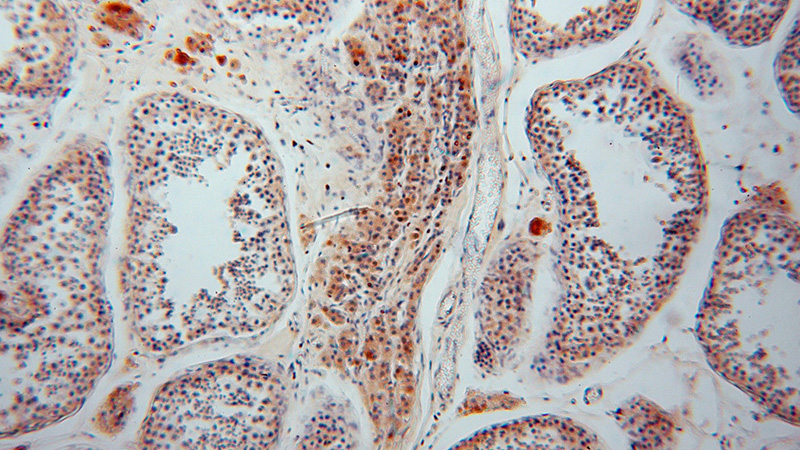 Immunohistochemical of paraffin-embedded human testis using Catalog No:113789(PGM1 antibody) at dilution of 1:100 (under 10x lens)