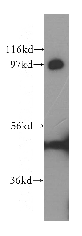 MCF7 cells were subjected to SDS PAGE followed by western blot with Catalog No:112497(MATR3 antibody) at dilution of 1:400