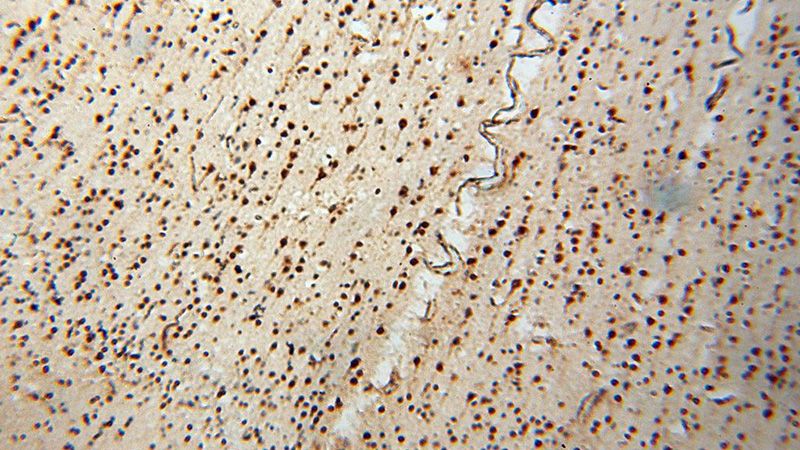 Immunohistochemical of paraffin-embedded human brain using Catalog No:116894(YTHDF1 antibody) at dilution of 1:100 (under 10x lens)