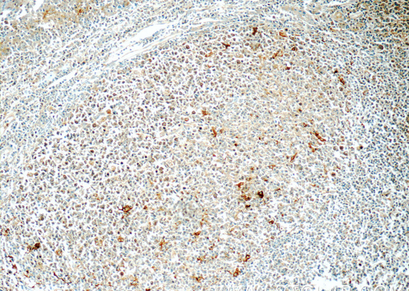 Immunohistochemistry of paraffin-embedded human tonsillitis tissue slide using Catalog No:109387(CLEC9A Antibody) at dilution of 1:50 (under 10x lens)