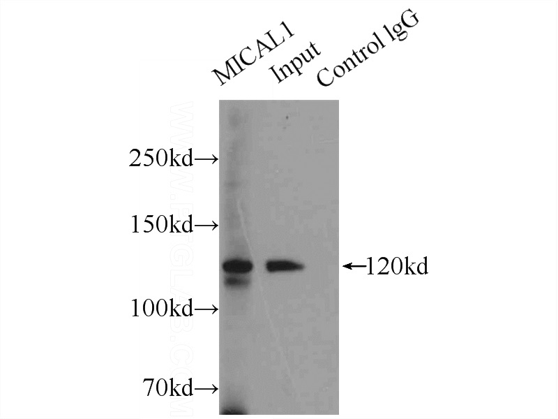 IP Result of anti-MICAL1 (IP:Catalog No:112609, 5ug; Detection:Catalog No:112609 1:1000) with HeLa cells lysate 2000ug.