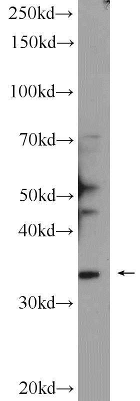 rat brain tissue were subjected to SDS PAGE followed by western blot with Catalog No:108276(ATAD1 Antibody) at dilution of 1:300