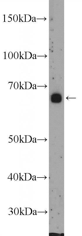 mouse spleen tissue were subjected to SDS PAGE followed by western blot with Catalog No:111854(INT11 Antibody) at dilution of 1:300