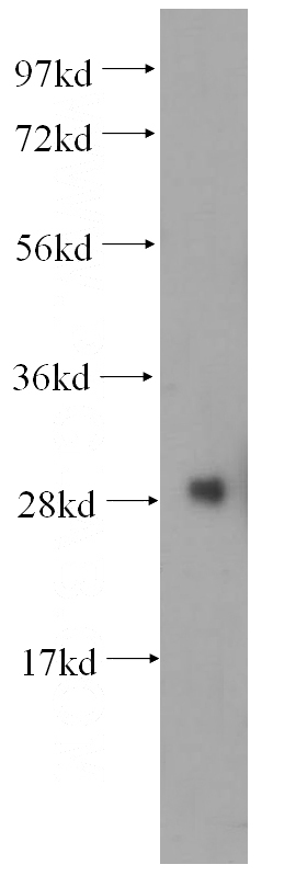 K-562 cells were subjected to SDS PAGE followed by western blot with Catalog No:114911(RPS6 antibody) at dilution of 1:500