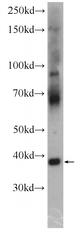 mouse brain tissue were subjected to SDS PAGE followed by western blot with Catalog No:114278(PRRT1 antibody) at dilution of 1:500
