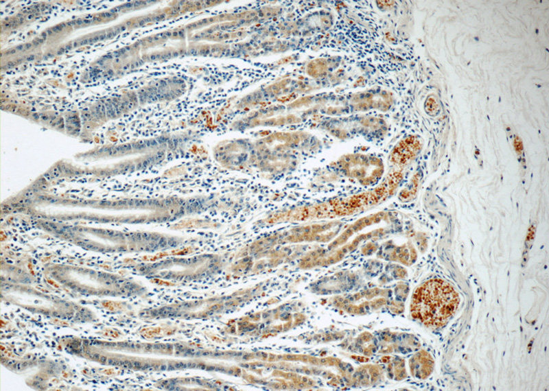 Immunohistochemistry of paraffin-embedded human stomach tissue slide using Catalog No:115425(SMAP1 Antibody) at dilution of 1:50 (under 10x lens)