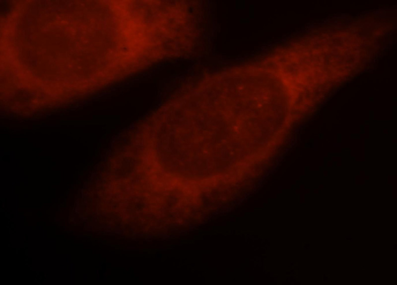 Immunofluorescent analysis of Hela cells, using PSMD13 antibody Catalog No:114396 at 1:25 dilution and Rhodamine-labeled goat anti-rabbit IgG (red).