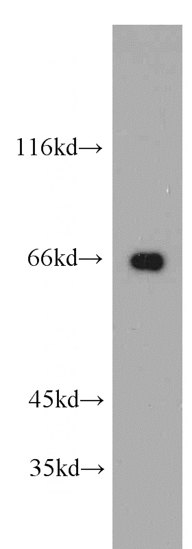 HepG2 cells were subjected to SDS PAGE followed by western blot with Catalog No:116600(USP22 antibody) at dilution of 1:300