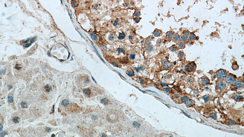 Immunohistochemical of paraffin-embedded human testis using Catalog No:108804(C9orf78 antibody) at dilution of 1:50 (under 40x lens)