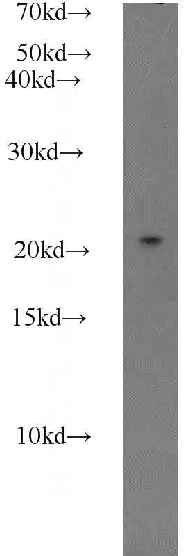 HEK-293 cells were subjected to SDS PAGE followed by western blot with Catalog No:114491(RABAC1 antibody) at dilution of 1:500