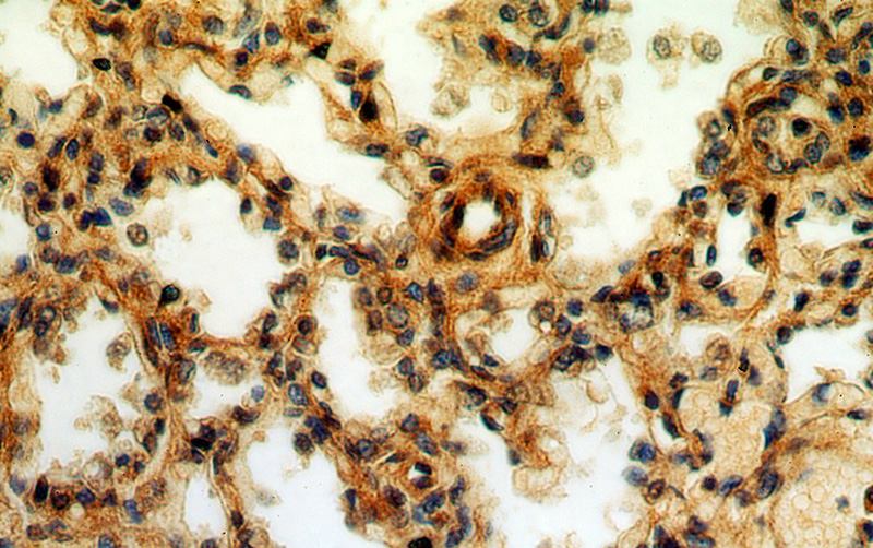 Immunohistochemical of paraffin-embedded human lung using Catalog No:109519(CPNE8 antibody) at dilution of 1:50 (under 40x lens)