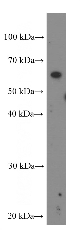 K-562 cells were subjected to SDS PAGE followed by western blot with Catalog No:107392(IL21R Antibody) at dilution of 1:1500
