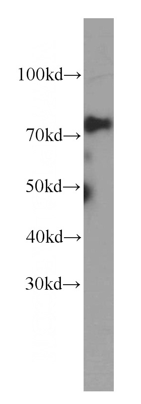 HeLa cells were subjected to SDS PAGE followed by western blot with Catalog No:107432(MTA2 Antibody) at dilution of 1:1000