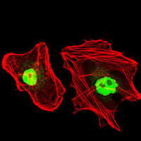 Immunofluorescence analysis of HeLa cells using RPA1 mouse mAb (green). Red