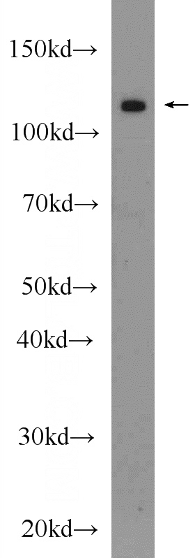 PC-3 cells were subjected to SDS PAGE followed by western blot with Catalog No:108717(C2orf67 Antibody) at dilution of 1:1000