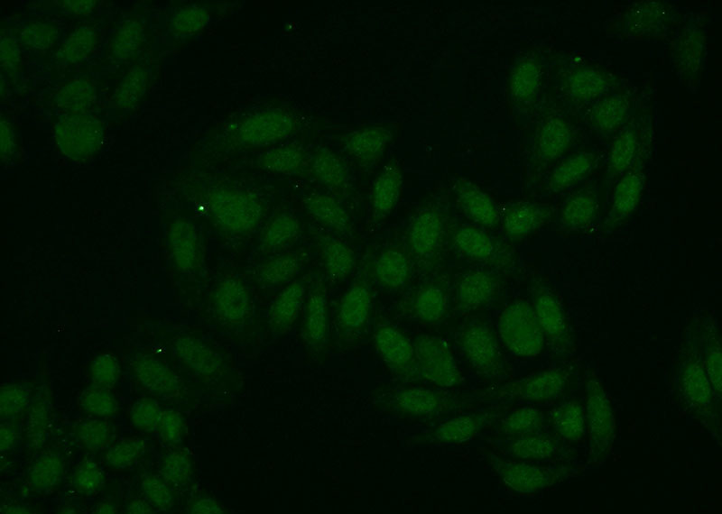 Immunofluorescent analysis of HepG2 cells using Catalog No:114061(POP4 Antibody) at dilution of 1:50 and Alexa Fluor 488-congugated AffiniPure Goat Anti-Rabbit IgG(H+L)
