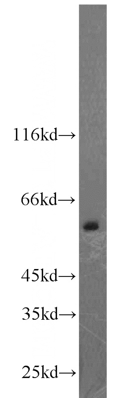 PC-3 cells were subjected to SDS PAGE followed by western blot with Catalog No:108924(CAMKK2 antibody) at dilution of 1:500