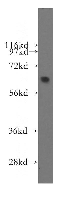 mouse lung tissue were subjected to SDS PAGE followed by western blot with Catalog No:115106(SEMA4F antibody) at dilution of 1:400