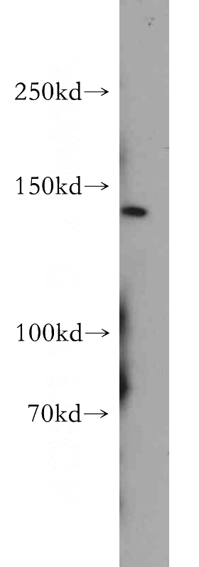 HepG2 cells were subjected to SDS PAGE followed by western blot with Catalog No:114263(PTCH2 antibody) at dilution of 1:500