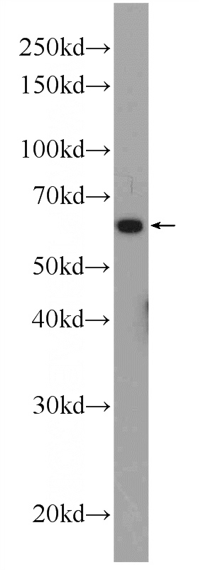 rat brain tissue were subjected to SDS PAGE followed by western blot with Catalog No:113810(PHF19 Antibody) at dilution of 1:300
