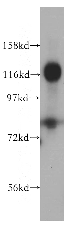HeLa cells were subjected to SDS PAGE followed by western blot with Catalog No:116306(TRIM24 antibody) at dilution of 1:500