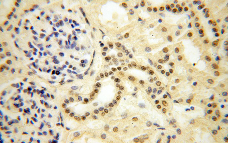 Immunohistochemical of paraffin-embedded human kidney using Catalog No:109170(CDKN2AIP antibody) at dilution of 1:100 (under 40x lens)