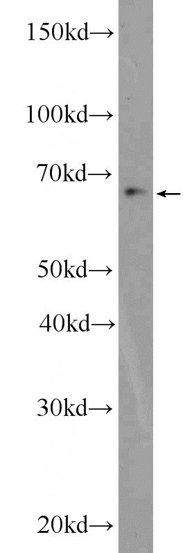RAW 264.7 cells were subjected to SDS PAGE followed by western blot with Catalog No:116918(ZBTB46 Antibody) at dilution of 1:600