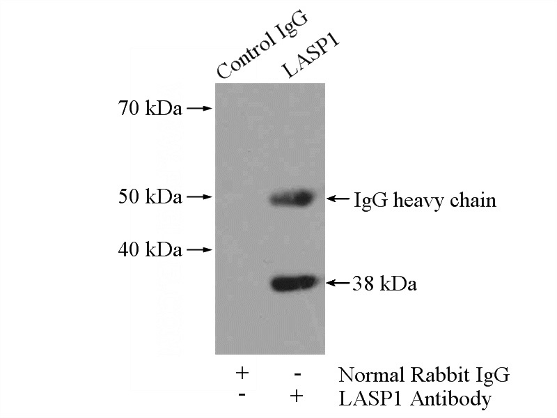 IP Result of anti-LASP1 (IP:Catalog No:112152, 4ug; Detection:Catalog No:112152 1:1500) with rat brain tissue lysate 4000ug.