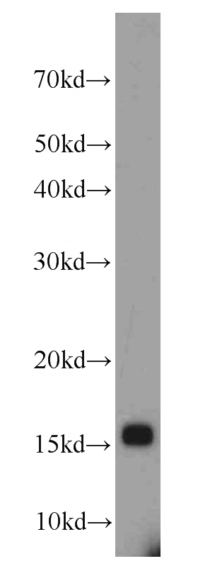 mouse testis tissue were subjected to SDS PAGE followed by western blot with Catalog No:114027(PMP2 antibody) at dilution of 1:1000