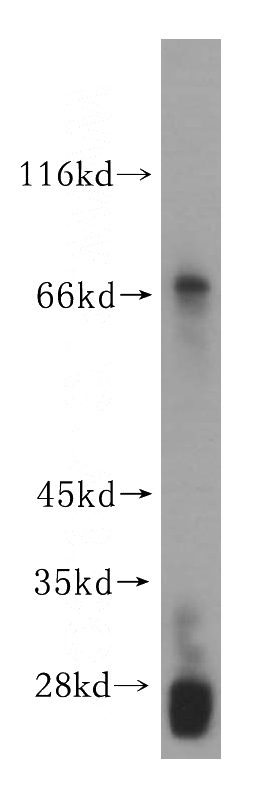 HEK-293 cells were subjected to SDS PAGE followed by western blot with Catalog No:110850(GALNTL2 antibody) at dilution of 1:200