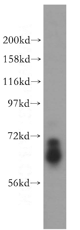 HL-60 cells were subjected to SDS PAGE followed by western blot with Catalog No:108179(ARHGAP9 antibody) at dilution of 1:500