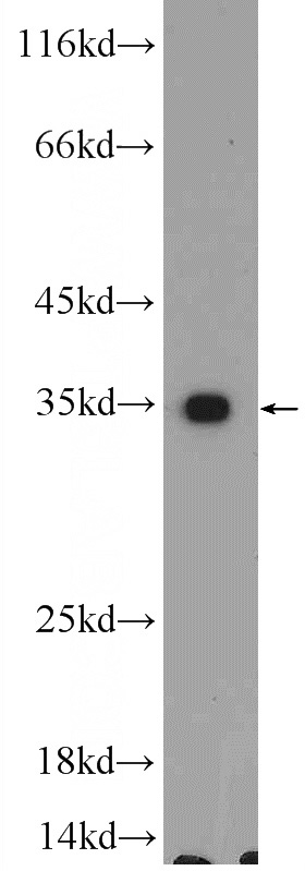 MCF-7 cells were subjected to SDS PAGE followed by western blot with Catalog No:116472(UBAC2 Antibody) at dilution of 1:600