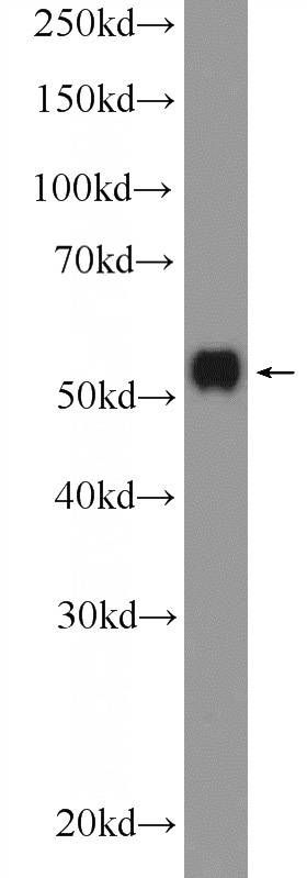 HepG2 cells were subjected to SDS PAGE followed by western blot with Catalog No:112681(MLKL Antibody) at dilution of 1:1000