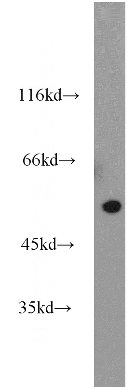 mouse brain tissue were subjected to SDS PAGE followed by western blot with Catalog No:116237(TRAIP antibody) at dilution of 1:1000