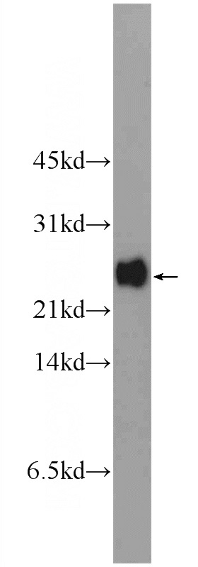 MCF-7 cells were subjected to SDS PAGE followed by western blot with Catalog No:114241(PRR13 Antibody) at dilution of 1:300