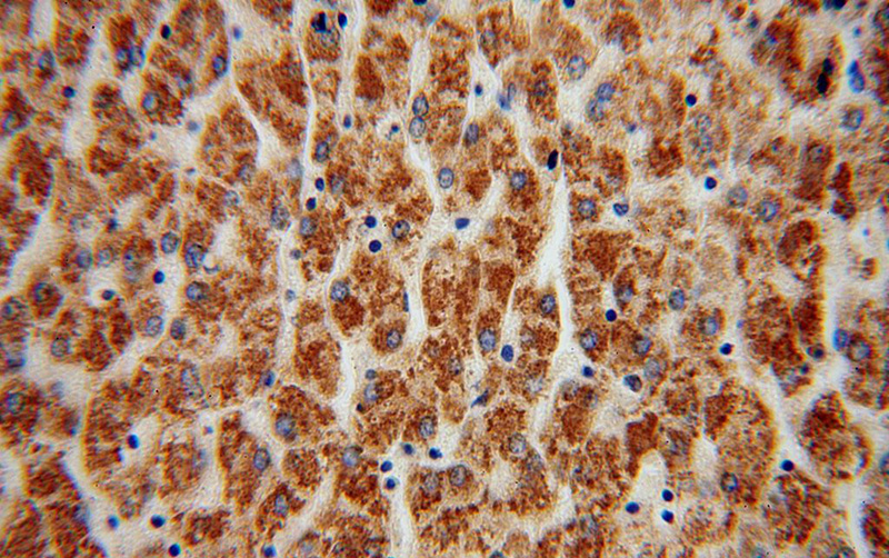 Immunohistochemical of paraffin-embedded human liver using Catalog No:108350(ATP5A1 antibody) at dilution of 1:100 (under 40x lens)