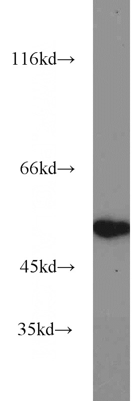mouse brain tissue were subjected to SDS PAGE followed by western blot with Catalog No:112701(MMP20 antibody) at dilution of 1:1000