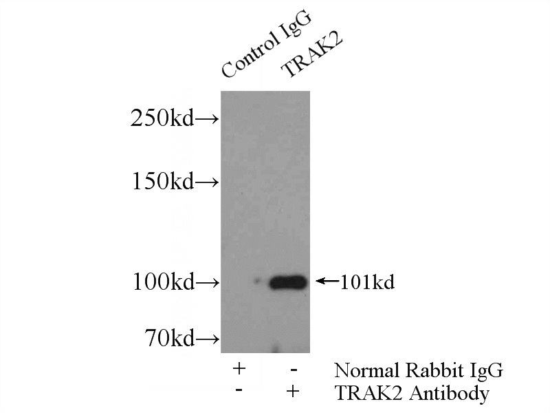 IP Result of anti-TRAK2 (IP:Catalog No:116238, 4ug; Detection:Catalog No:116238 1:500) with HepG2 cells lysate 4000ug.
