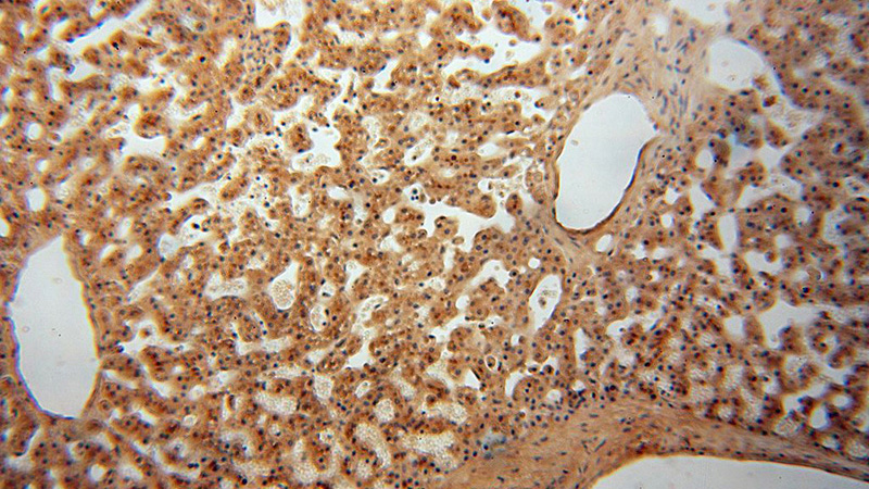 Immunohistochemical of paraffin-embedded human liver using Catalog No:116552(UFSP2 antibody) at dilution of 1:100 (under 10x lens)
