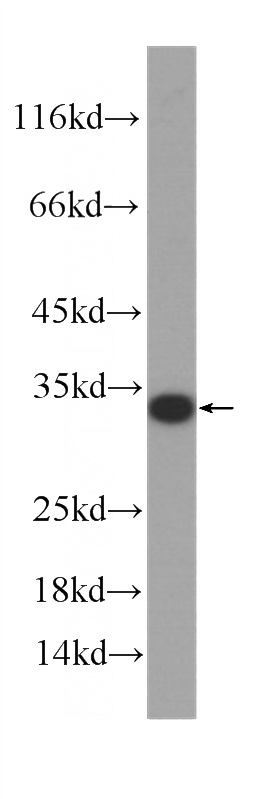 human heart tissue were subjected to SDS PAGE followed by western blot with Catalog No:107072(ATP5C1 Antibody) at dilution of 1:1000