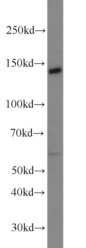 NIH/3T3 cells were subjected to SDS PAGE followed by western blot with Catalog No:112498(MATN2 antibody) at dilution of 1:800