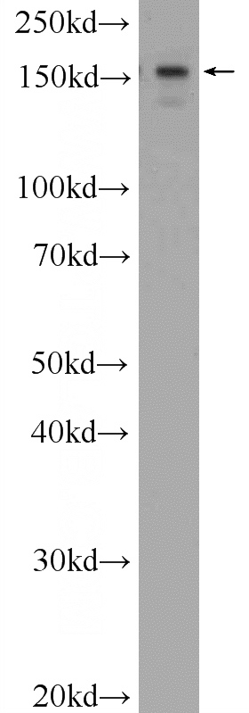 HeLa cells were subjected to SDS PAGE followed by western blot with Catalog No:108277(ATAD2 Antibody) at dilution of 1:600
