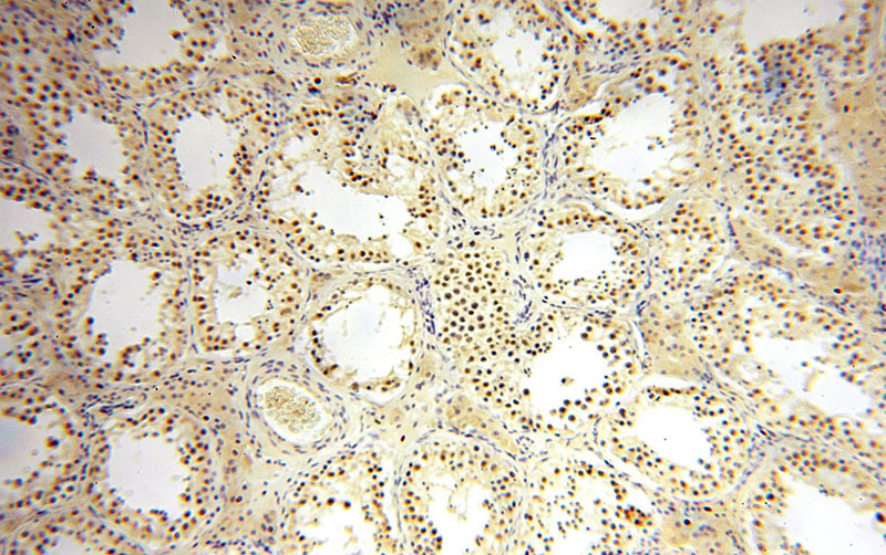 Immunohistochemical of paraffin-embedded human testis using Catalog No:110407(ERCC1 antibody) at dilution of 1:50 (under 10x lens)