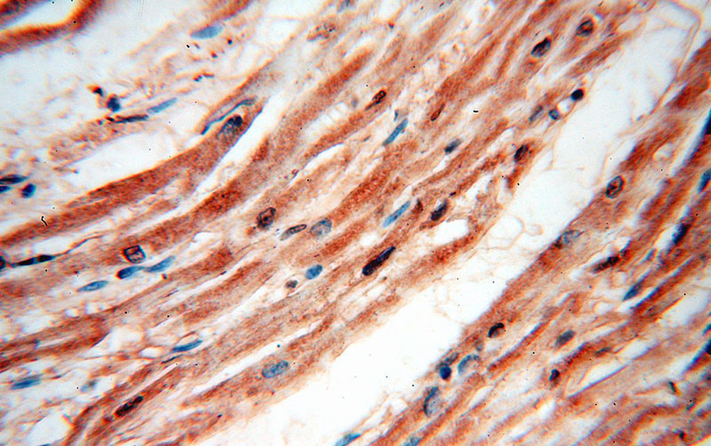 Immunohistochemical of paraffin-embedded human heart using Catalog No:109568(XPO1 antibody) at dilution of 1:50 (under 40x lens)